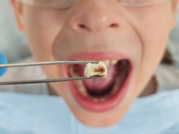 Best Emergency Treatment for Jaw Pain or Injury in Kemah, TX