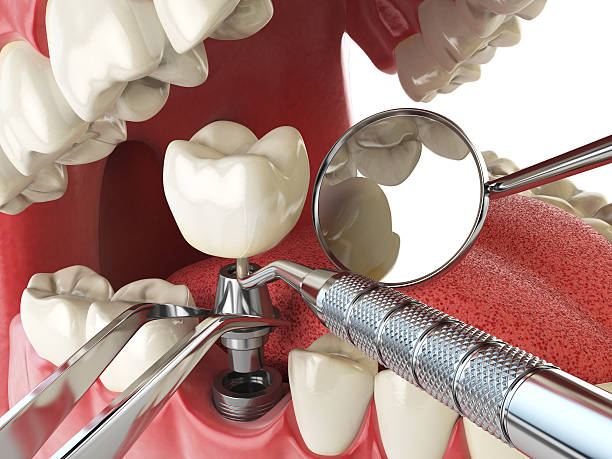 Best Emergency Treatment for Jaw Pain or Injury in Kemah, TX